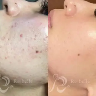 ank所属・ank アンクのマツエク・マツパデザイン