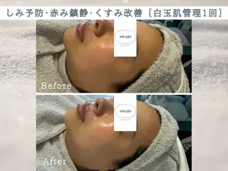 swan(スワン) 韓国肌管理 南堀江のエステ・リラクイメージ