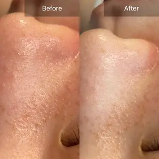 Mandarin Orange所属・毛穴から始める肌メン テマンダリンオレンジのエステ・リラクイメージ