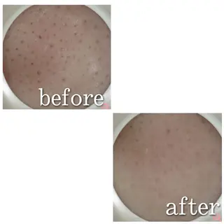 ショート カラー パーマ ヘアアレンジ メンズ キッズ ネイル マツエク・マツパ アイブロウ ニキビ特化型エステ 🍓最短で肌質改善のエステ・リラクイメージ