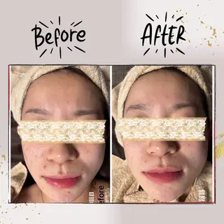 ピーリング専門店 Belluteのエステ・リラクイメージ