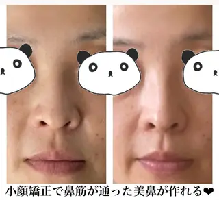 糸島 エステサロンmiuのエステ・リラクイメージ