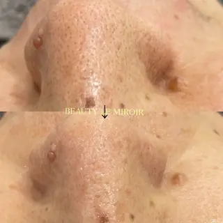 マツエク・マツパ ビューティー ミロワールのエステ・リラクイメージ