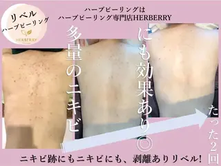 ハーブピーリング専門店HERBERRY難波心斎橋店所属・ハーブピーリング専門 HERBERRY冨永のエステ・リラクイメージ