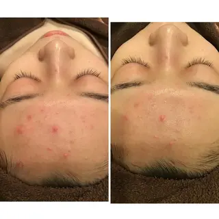 レイビス八戸店 野口のエステ・リラクイメージ