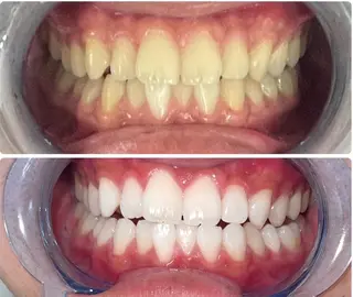 ホワイトニング/脱毛 サロン　麗　御徒町のその他イメージ