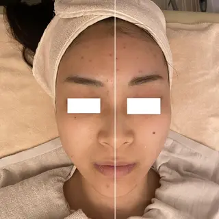 ララ/ハーブ メゾンリュバンのエステ・リラクイメージ