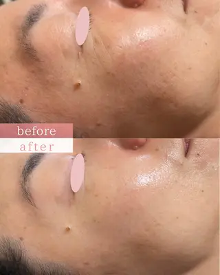 肌質改善サロン LesFleursのエステ・リラクイメージ