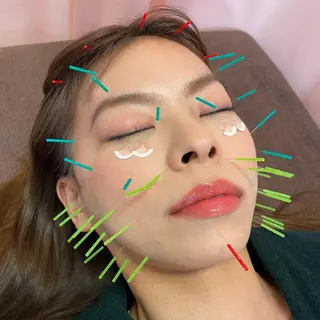 同心整骨院 美容鍼・整体・小顔のエステ・リラクイメージ