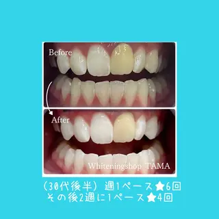 ホワイトニング ショップ多摩店のその他イメージ