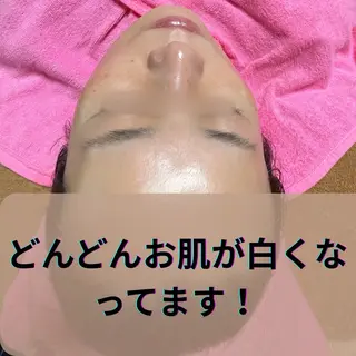 韓国肌&ララピール シミケア　せんすのエステ・リラクイメージ