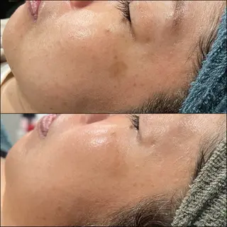 LiZA エステティックサロンのエステ・リラクイメージ