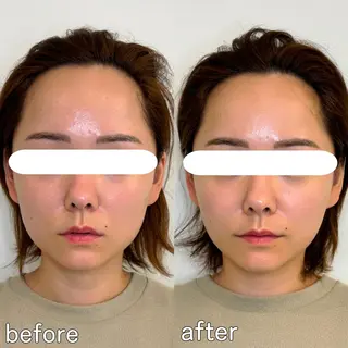 小顔矯正&美容整体 整え屋REDオーナーのエステ・リラクイメージ