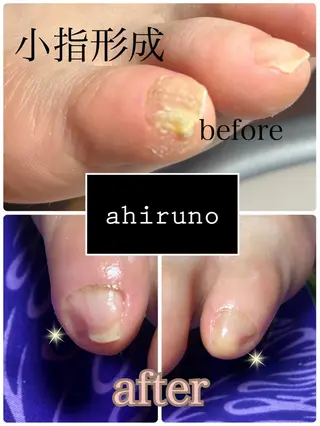 ネイル ａｈｉｒｕｎｏ ✿ ｙｕiのネイルデザイン