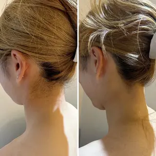 うなじ脱毛/美肌脱毛 LABELのエステ・リラクイメージ