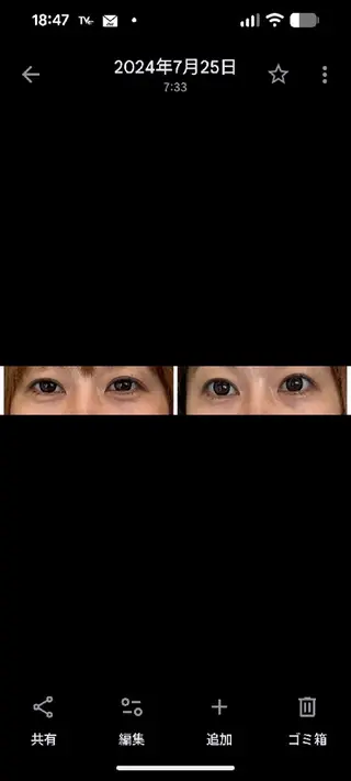 フェイシャルエステ アンソン・ドゥのエステ・リラクイメージ