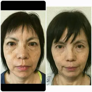 プログレス所属・秋山 香織のエステ・リラクイメージ