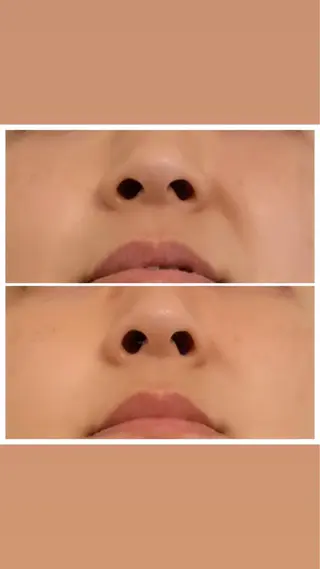 喜山 あつこのエステ・リラクイメージ