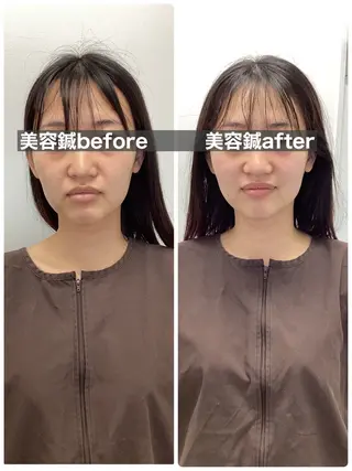 メディカルサロンドオフ所属・ハリサロンドオフ 美容鍼灸×小顔整体のエステ・リラクイメージ