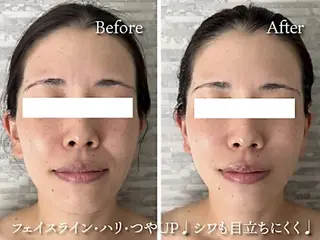 refiel たまプラーザ店所属・藤井 りさのエステ・リラクイメージ