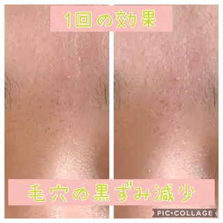 癒し腸もみサロン シャユーム　ゆきなのエステ・リラクイメージ