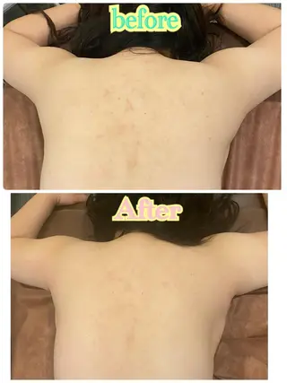 メンズ HappIness所属・小林 紗緒里のエステ・リラクイメージ