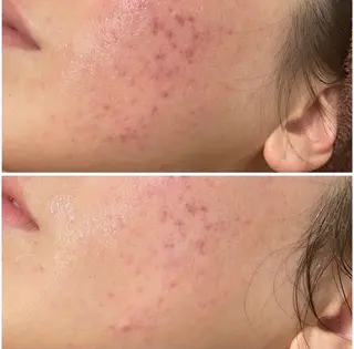 Beauty&skin Dahlia所属・ダリア 盛岡店のエステ・リラクイメージ