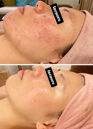 la   cuore所属・la   cuore 🌹ラ クオーレ🌹のエステ・リラクイメージ