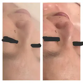 ネイル フェアリーローズ所属・fairyrose organicエステのエステ・リラクイメージ