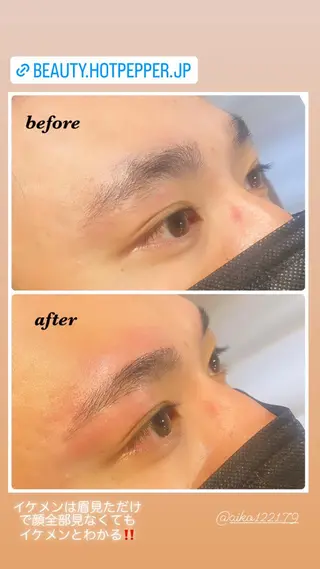 アイブロウ ハーブピーリング/韓国肌管理/フェイシャル/毛穴洗浄/眉毛/顔脱毛【糸脱毛専門】rev所属・ハーブピーリング🌹 毛穴洗浄❤️眉waxのエステ・リラクイメージ