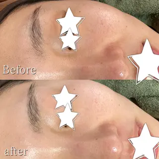 脱毛サロン KiWiのエステ・リラクイメージ