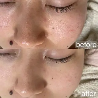 アイブロウ&フェイシャルサロンa‘lm所属・WAX脱毛/肌質改善 眉毛とお肌のサロンのエステ・リラクイメージ