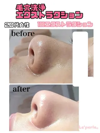 Le'perle｡所属・Le'perle｡ Kyokaのエステ・リラクイメージ