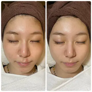 cicer よもぎ蒸し・ハーブピーリング所属・cicer🌿 Naomi☺︎☺︎のエステ・リラクイメージ