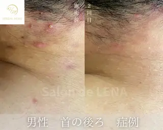 ハーブピーリング・毛穴ケア専門サロンSalon de LENA 栄店所属・ハーブピーリング専門 サロンドレナ　白藤のエステ・リラクイメージ