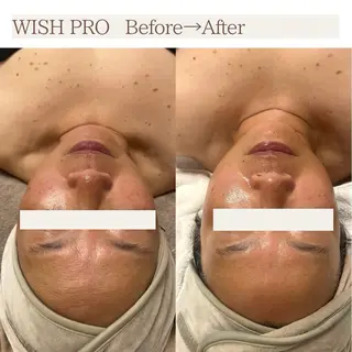 Total Beauty salon Bloom所属・肌育WISHpro 専門サロンBloomのエステ・リラクイメージ