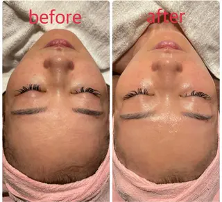 調律エステ /美KISSのその他イメージ