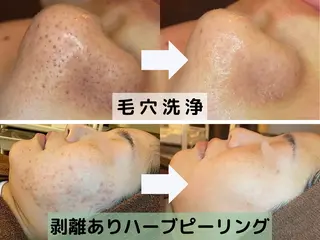 【肌質改善サロン】 医療提携シャルムのエステ・リラクイメージ