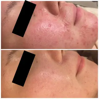 触れたくなる モテ肌へ...❤︎のエステ・リラクイメージ