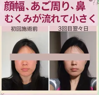 リフトアップ小顔 プランドール所属・痛くない小顔矯正 いまいあやののその他イメージ