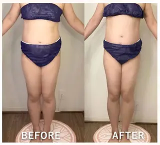 hitohana所属・毛穴/いちご鼻/小顔 /hitohanaのエステ・リラクイメージ