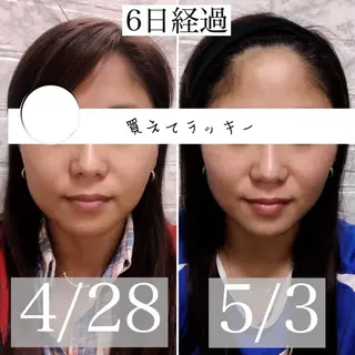 小顔矯正/美容整体 /骨盤矯正✨+Mi2のエステ・リラクイメージ