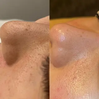 アイスリーサロン所属・毛穴改善サロン アイスリーのエステ・リラクイメージ