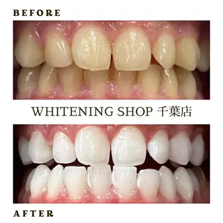 メンズ ホワイトニング ショップ千葉店のその他イメージ