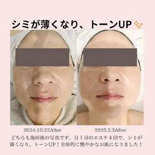 PRETTIEST SHINE所属・フェイシャル/ボディ /ブライダル山田浩子のエステ・リラクイメージ