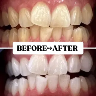 メンズ キッズ 歯科提携サロン ホワイトニング豊中のその他イメージ