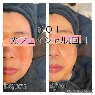 soi所属・soi 平賀愛のエステ・リラクイメージ