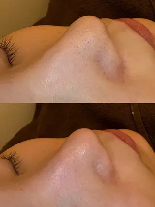 EARTH coiffure beaute 新潟紫竹山店所属・🤍アベシュリ /フェイシャル🤍のエステ・リラクイメージ