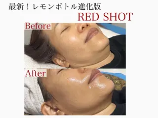 🌸🧡六本木 脱毛しずか🧡🫧の眉毛・アイブロウイメージ