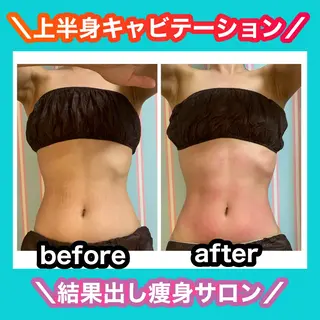 痩身/脱毛/ネイル HARUKAのエステ・リラクイメージ